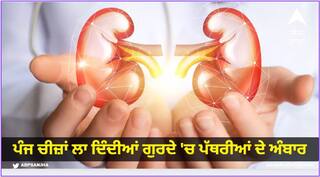 Health : ਪੰਜ ਚੀਜ਼ਾਂ ਲਾ ਦਿੰਦੀਆਂ ਗੁਰਦੇ 'ਚ ਪੱਥਰੀਆਂ ਦੇ ਅੰਬਾਰ, ਲੋੜ ਤੋਂ ਜ਼ਿਆਦਾ ਖਾਓਗੇ ਤਾਂ ਕਰਾਉਣਾ ਪਵੇਗਾ ਆਪ੍ਰੇਸ਼ਨ