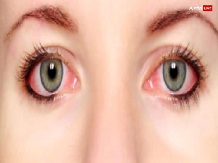 Eye Flu: आंखों के रोग बढ़ते जा रहे हैं, आई फ्लू का इन्फेक्शन आग की तरह फैल रहा है. इससे बचने के लिए डॉक्टरी इलाज के अलावा कुछ ऐसे ज्योतिष उपाय भी है जो आपकी आंखों को सुरक्षित रखने में मदद करेंगे.