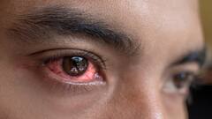 Eye Flu Precautions: આઇ ફ્લૂ થયા બાદ ભૂલચૂકે પણ ન કરો આ Mistake, વધશે તકલીફ