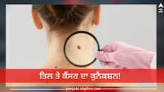 Health News: ਤਿਲ ਤੇ ਕੈਂਸਰ ਦਾ ਕੁਨੈਕਸ਼ਨ! ਜੇ ਤਿਲ 'ਚ ਨਜ਼ਰ ਆਉਣ 10 ਬਦਲਾਅ ਤਾਂ ਤੁਰੰਤ ਡਾਕਟਰ ਕੋਲ ਪਹੁੰਚੋ