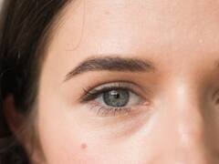 आंख में सूजन को महिला ने कर दिया इग्नोर, जब डॉक्टर ने की जांच तो निकली ये 'भयंकर बीमारी'