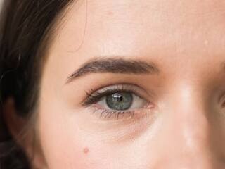 आंख में सूजन को महिला ने कर दिया इग्नोर, जब डॉक्टर ने की जांच तो निकली ये 'भयंकर बीमारी'