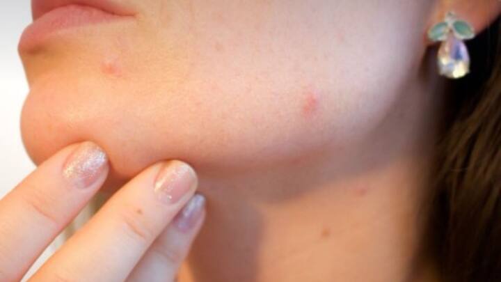 প্রত্যেক দিন ঘরে-বাইরে নানা ধরনের ব্যস্ততার মধ্যে ত্বকের পরিচর্যা নিয়ে সে ভাবে ভাবার সময় কোথায়? কিন্তু বহু ক্ষেত্রে তাতে ত্বকের সমস্যা বাড়ে বই কমে না।