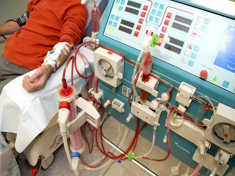 Dialysis will be closed in the state for three days from tomorrow, know what is the demand of Gujarat Nephrology Association Dialysis: રાજ્યમાં આવતીકાલથી ત્રણ દિવસ બંધ રહેશે ડાયાલિસિસ, જાણો ગુજરાત નેફ્રોલોજી એસોસિએશનની શું છે માંગ