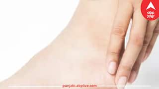 Health: ਸਰੀਰ 'ਚ ਇਨ੍ਹਾਂ ਥਾਵਾਂ 'ਤੇ ਸੋਜ ਹੋਣਾ ਹੋ ਸਕਦਾ ਖਤਰਨਾਕ, ਹੋ ਸਕਦੇ ਗੰਭੀਰ ਬਿਮਾਰੀ ਦੇ ਲੱਛਣ