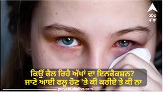 Eye Flu : ਕਿਉਂ ਫੈਲ ਰਿਹੈ ਅੱਖਾਂ ਦਾ ਇਨਫੈਕਸ਼ਨ? ਜਾਣੋ ਆਈ ਫਲੂ ਹੋਣ 'ਤੇ ਕੀ ਕਰੀਏ ਤੇ ਕੀ ਨਾ