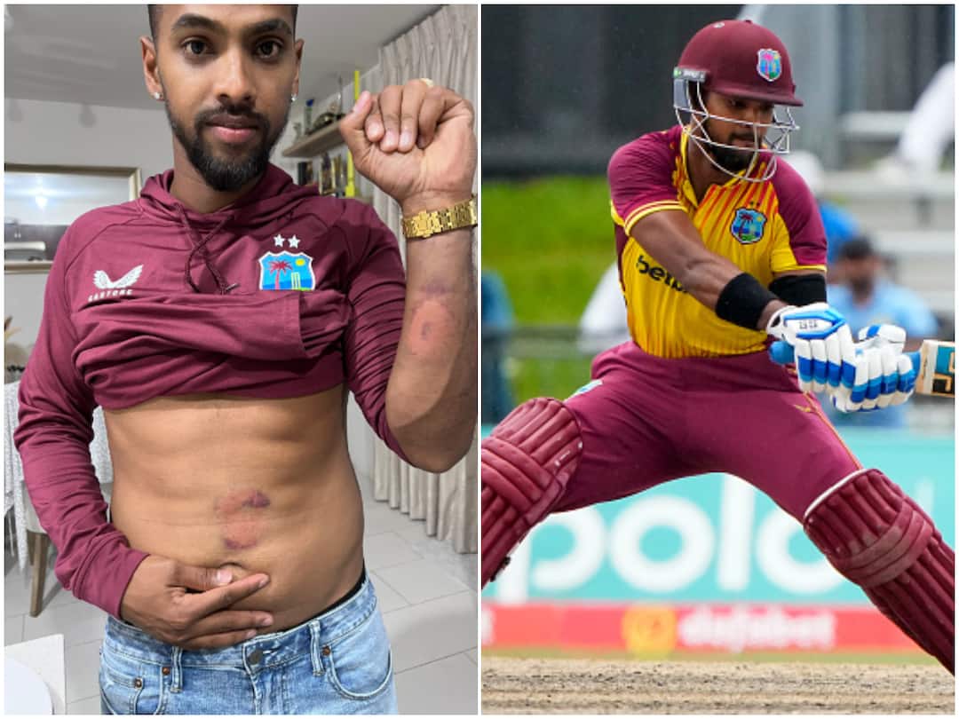 India vs West Indies 5th T20 Highlights Nicholas Pooran Bruises Brandon King Arshdeep Singh IND WI 5th T20I Nicholas Pooran Shows Bruises Off Brandon King's Shot & Arshdeep Singh's Delivery In 5th T20I