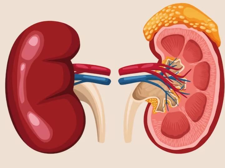 क्या एक किडनी डोनेट के बाद नॉर्मल लाइफ जी सकते हैं? फिर लाइफ में आ जाता है ये बदलाव