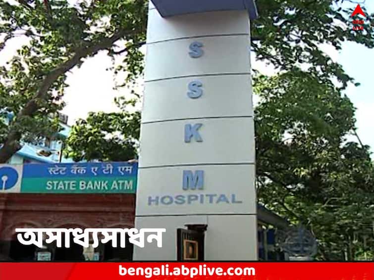 Kolkata SSKM Hospital doctors successfully operates child with scissor stuck on forehead SSKM Hospital: কপাল ও চোখের মাঝে বিঁধে কাঁচি, SSKM-এ আবারও বিরল অস্ত্রোপচার, নতুন জীবন পেল শিশু