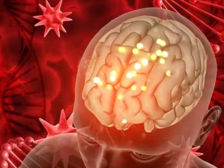 બ્રેઇન ટ્યુમરનો ઉલ્લેખ કરતા ડોક્ટર્સ કહે છે કે આ બીમારીમાં શરૂઆતમાં માથાનો દુખાવો હળવો હોય છે પરંતુ સમય જતાં તેની તીવ્રતા વધતી જાય છે.