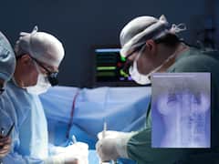 కాన్పు చేశారు, కడుపులోనే కత్తెర మరిచారు - అసలేం జరిగిందంటే?