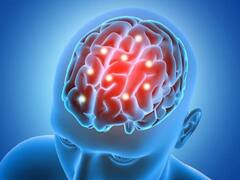 Brain Tumor: सिर के मामूली दर्द से शुरू होता है ब्रेन ट्यूमर के लक्षण, न करें इग्नोर...