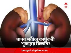 গবেষণায় আশার আলো, ৩২ দিন পার, মানবশরীরে দিব্য চলছে শূকরের কিডনি !