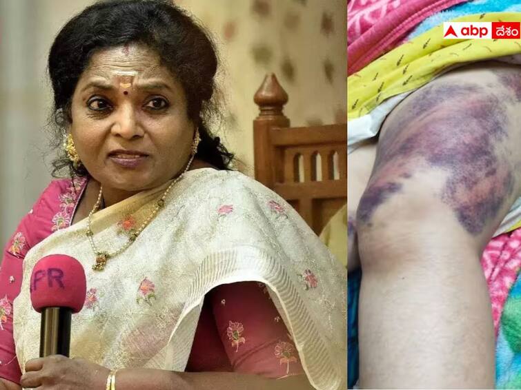 Telangana Governor Tamilisai Serious on LB Nagar police who beats women in hyderabad Tamilisai Serious On Police: అర్ధరాత్రి మహిళపై పోలీసుల దాడి, గవర్నర్‌ తమిళిసై ఆగ్రహం- నివేదిక ఇవ్వాలని ఆదేశాలు