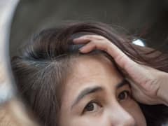 20-25 की उम्र में बाल सफेद होना नॉर्मल बात नहीं, इसके पीछे हो सकती हैं ये वजहें