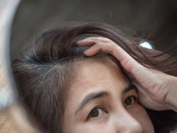 20-25 की उम्र में बाल सफेद होना नॉर्मल बात नहीं, इसके पीछे हो सकती हैं ये वजहें