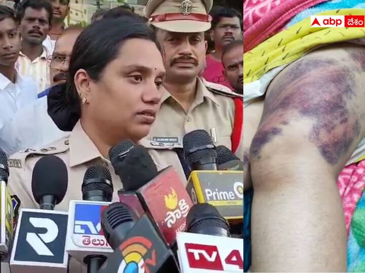 Hyderabad NewsCase Filed against LB Nagar Police Who Beats Woman In PS Hyderabad News: రాత్రంతా మహిళపై పీఎస్‌లో థర్డ్ డిగ్రీ - ఎల్బీ నగర్ పోలీసులపై కేసు నమోదు