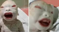 Viral News: 9 ਮਹੀਨਿਆਂ ਬਾਅਦ ਖੁਸ਼ੀ ਨਾਲ ਹਸਪਤਾਲ ਪਹੁੰਚੀ ਔਰਤ, ਕੁੱਖ ਤੋਂ ਹੋਇਆ ਅਜਿਹਾ ਬੱਚਾ, ਦੇਖ ਕੇ ਮਾਂ ਦੇ ਵੀ ਉੱਡ ਗਏ ਹੋਸ਼!