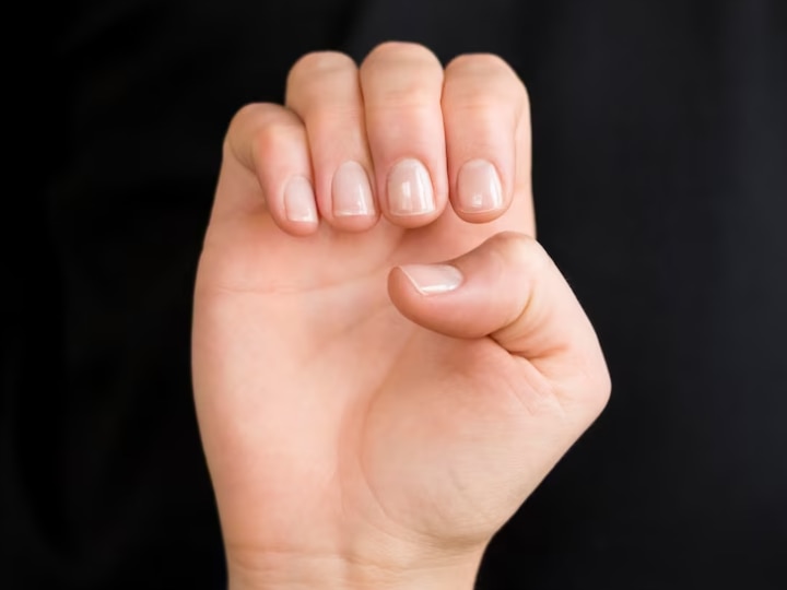Check your nails for melanoma - Medical Forum