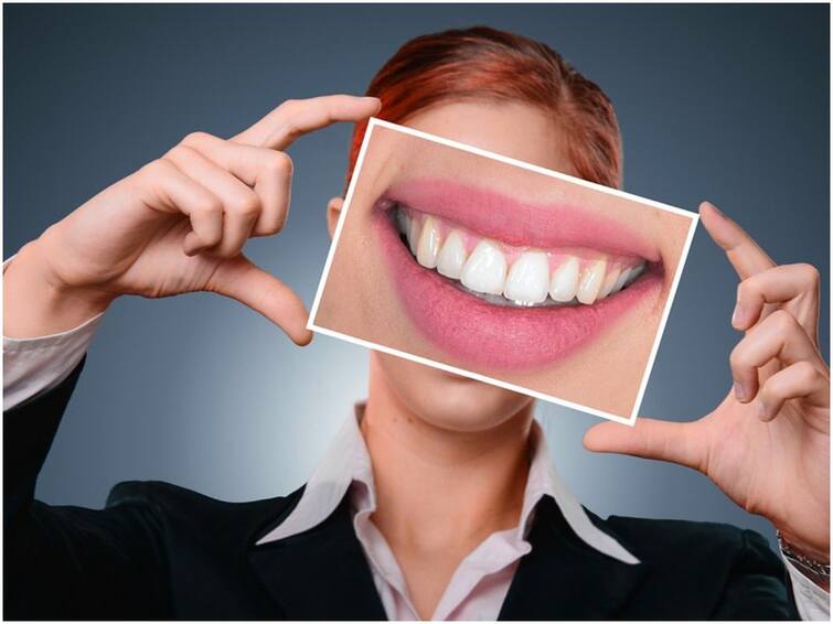 Teeth Whitening Process Is Really Works Or Not Teeth Whitening: టీత్ వైటనింగ్‌తో దంతాలు తెల్లగా మారుతాయా?