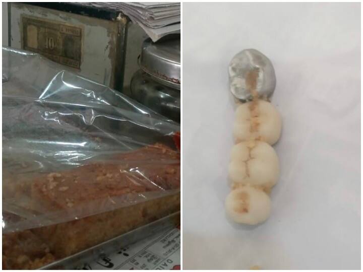 teeth set in a cake eaten at a bakery shop in Villupuram Villupuram: பேக்கரி கடையில் சாப்பிட்ட கேக்கில் பல்செட்... அதிர்ச்சியில் உறைந்த வாடிக்கையாளர்..!