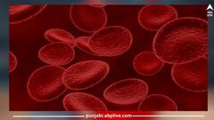 Increase Platelets: ਡੇਂਗੂ ਮਲੇਰੀਆ ਕਾਰਨ ਘੱਟਦੇ ਜਾ ਰਹੇ ਪਲੇਟਲੈਟਸ, ਤਾਂ ਆਪਣੀ ਖੁਰਾਕ 'ਚ ਸ਼ਾਮਲ ਕਰੋ ਇਹ ਕੁੱਝ ਚੀਜ਼ਾਂ, ਤੁਰੰਤ ਹੋਵੇਗਾ ਵਾਧਾ