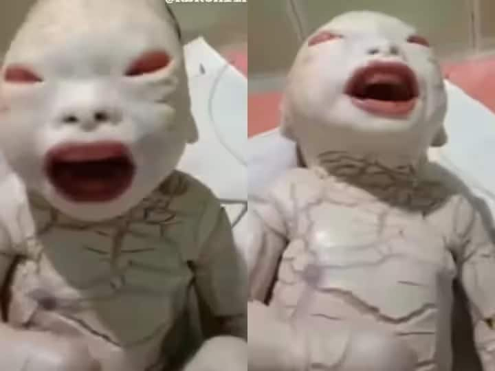 alien like baby born woman gave birth child with harlequin ichthyosis genetic disorder that affects skin video viral Viral Video : एलियनप्रमाणे दिसणाऱ्या बाळाचा जन्म, सोशल मीडियावर चर्चांना उधाण; तुम्ही व्हिडीओ पाहिला का?