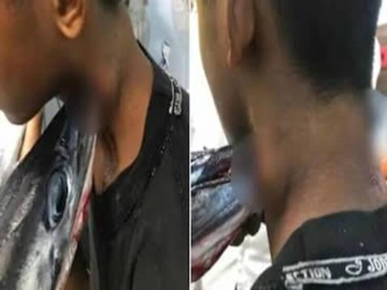 Indonesia Terror in Fishing A needlefish that came straight to the neck and pierce through the man miraculously survived மீன் பிடிக்கும்போது பயங்கரம்; கழுத்தில் நேராக வந்து சொருகிய ஊசிமீன்… அதிசயமாக உயிர்பிழைத்த இளைஞன்!