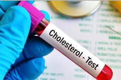 Lifestyle:কোলেস্টেরল নিয়ন্ত্রণে এগুলি করছেন তো?