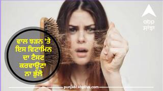 Hair Fall : ਵਾਲ ਝੜਨ ਤੇ ਇਸ ਵਿਟਾਮਿਨ ਦਾ ਟੈਸਟ ਕਰਵਾਉਣਾ ਨਾ ਭੁੱਲੋ, ਹੋ ਸਕਦੀ ਹੈ ਇਸ ਦੀ ਕਮੀ