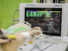 मरने के बाद सबसे ज्यादा देर तक जिंदा रहते हैं शरीर के ये अंग, इतनी देर में होता है ट्रांसप्लांट