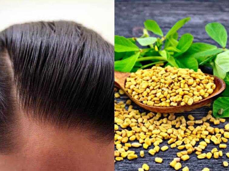 Fenugreek Seeds To grow black hair Fenugreek Medicinal Uses How To Use Fenugreek Seeds: கரு கருன்னு முடி வளர.. வெந்தயத்தின் மருத்துவப் பயன்கள்… எப்படி பயன்படுத்த வேண்டும்?