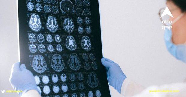 live worm found in womans brain in Australia doctors were shocked to know Viral News: ਔਰਤ ਦੇ ਦਿਮਾਗ 'ਚ ਮਿਲਿਆ ਸੱਪਾਂ 'ਚ ਪਾਇਆ ਜਾਣ ਵਾਲਾ ਜ਼ਿੰਦਾ ਕੀੜਾ, ਡਾਕਟਰਾਂ ਦੇ ਉੱਡ ਗਏ ਹੋਸ਼, ਦੁਨੀਆ 'ਚ ਪਹਿਲੀ ਘਟਨਾ