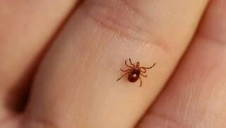 After Amreli Lilia, Savarkundla receives a case of Congo fever, know what are the symptoms Amreli: લીલીયા બાદ સાવરકુંડલામાં કોંગો ફીવરનો કેસ મળતા ફફડાટ, જાણો કેવા હોય છે લક્ષણો