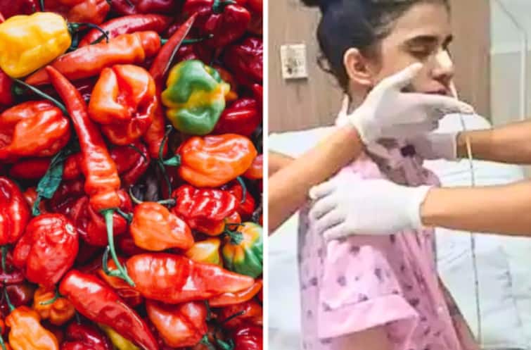 woman hospitalized with serious brain swelling from sniffing a super spicy chili pepper Viral News: ਮਿਰਚ ਸੂੰਘਣਾ ਔਰਤ ਨੂੰ ਪੈ ਗਿਆ ਭਾਰੀ, 6 ਮਹੀਨਿਆਂ ਤੋਂ ਹਸਪਤਾਲ 'ਚ ਦਾਖਲ