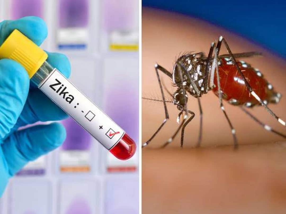 A 15-year-old girl in Mumbai has been confirmed to be infected with the Zika virus Zika Virus: மும்பையில் பரவும் ஜிகா வைரஸ்.. 15 வயது சிறுமிக்கு தொற்று பாதிப்பு உறுதி..