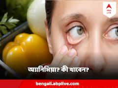 অ্যানিমিয়ায় ভুগছেন, নিরামিষ খাবার থেকেই পাবেন ভরপুর আয়রন