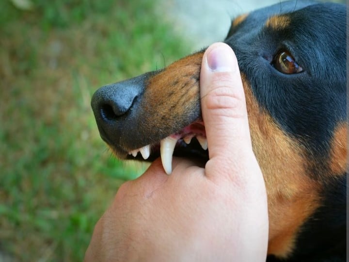 health tips what to do after dog bite know when should the injection be done कुत्ता काटे तो न करें लापरवाही, इतने घंटे में लगवा लें इंजेक्शन, वर्ना हो सकती है मौत