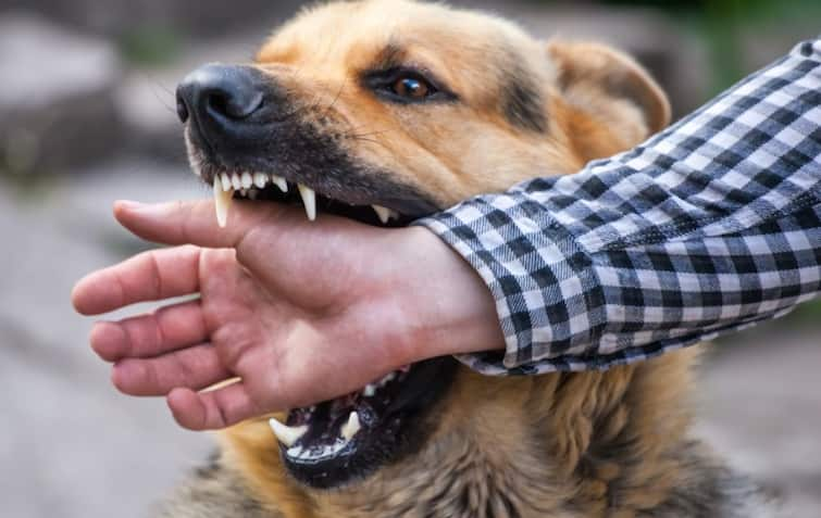 If a dog bites you, do not be careless, get the injection done within this hour, otherwise death may occur કૂતરો કરડે તો બેદરકારી ન રાખો, આટલા કલાકમાં ઈન્જેક્શન લગાવો, નહીં તો થઈ શકે છે મોત