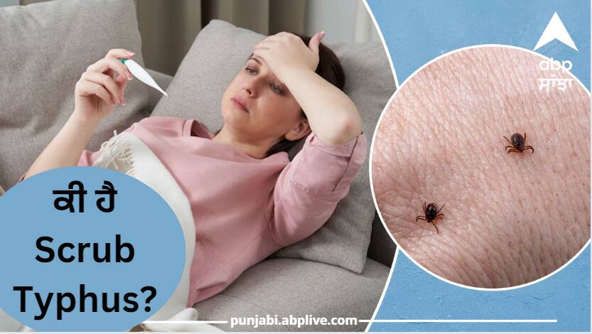 What is scrub typhus Who has created a stir in Himachal Pradesh Health News : ਕੀ ਹੈ Scrub Typhus? ਜਿਸ ਨੇ ਹਿਮਾਚਲ ਪ੍ਰਦੇਸ਼ ਵਿੱਚ ਮਚਾਇਆ ਹੜਕੰਪ!