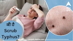 Health News : ਕੀ ਹੈ Scrub Typhus? ਜਿਸ ਨੇ ਹਿਮਾਚਲ ਪ੍ਰਦੇਸ਼ ਵਿੱਚ ਮਚਾਇਆ ਹੜਕੰਪ!