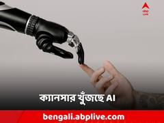 গলব্লাডার ক্যানসার খুঁজল AI! টেক্কা অভিজ্ঞ চিকিৎসকদেরও