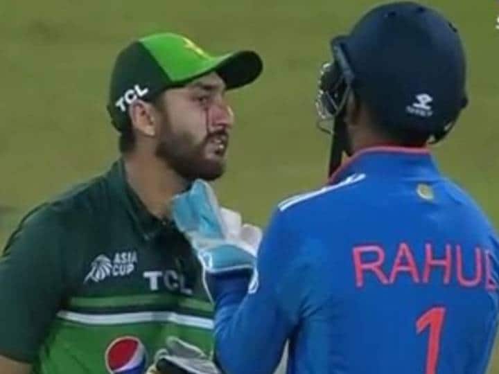 Blood came out from the face of Pak batsman on Jadeja’s ball, then KL Rahul won the hearts of the fans like this.