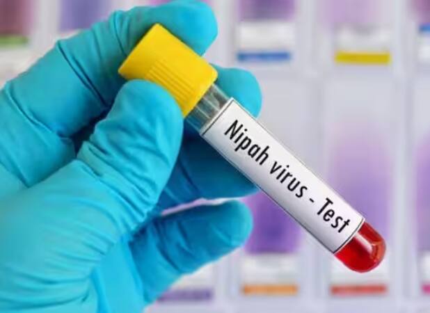 ਨਿਪਾਹ ਵਾਇਰਸ ਇੱਕ ਜ਼ੂਨੋਟਿਕ ਬਿਮਾਰੀ ਹੈ ਜੋ ਜਾਨਵਰਾਂ ਤੋਂ ਮਨੁੱਖਾਂ ਵਿੱਚ ਫੈਲਦੀ ਹੈ। ਇਹ ਖਾਸ ਕਰਕੇ ਚਮਗਿੱਦੜਾਂ ਰਾਹੀਂ ਫੈਲਦਾ ਹੈ। ਪਰ ਇਸ ਤੋਂ ਇਲਾਵਾ ਇਹ ਸੂਰ, ਬੱਕਰੀ, ਘੋੜੇ, ਕੁੱਤੇ ਅਤੇ ਬਿੱਲੀ ਰਾਹੀਂ ਵੀ ਫੈਲ ਸਕਦਾ ਹੈ। ਸਭ ਤੋਂ ਮਹੱਤਵਪੂਰਨ ਗੱਲ ਇਹ ਹੈ ਕਿ ਇਹ ਹਵਾ ਰਾਹੀਂ ਨਹੀਂ ਫੈਲਦਾ ਪਰ ਕਿਸੇ ਵੀ ਵਸਤੂ ਜਾਂ ਬਾਲਣ ਵਾਲੀਆਂ ਬੂੰਦਾਂ ਰਾਹੀਂ ਫੈਲ ਸਕਦਾ ਹੈ।