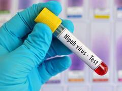 Nipah Virus: निपाह वायरस के लक्षण क्या है, यह कैसे जानवरों से इंसानों में फैलता है?