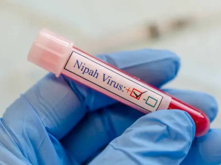 निपाह वायरस (Nipah Virus) की बीमारी एक जूनोटिक बीमारी है जो जानवरों से इंसानों मे फैलता है.
