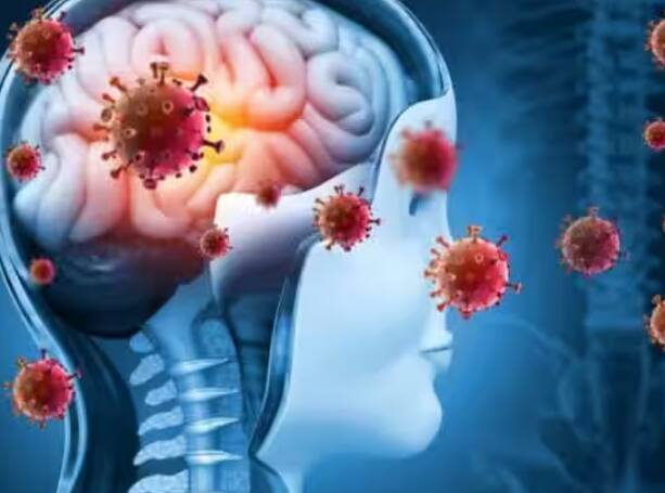 'ਵਰਲਡ ਹੈਲਥ ਆਰਗੇਨਾਈਜ਼ੇਸ਼ਨ' ਮੁਤਾਬਕ ਨਿਪਾਹ ਵਾਇਰਸ ਤੋਂ ਬਚਾਅ ਲਈ ਫਿਲਹਾਲ ਕੋਈ ਦਵਾਈ ਜਾਂ ਵੈਕਸੀਨ ਬਾਜ਼ਾਰ 'ਚ ਉਪਲਬਧ ਨਹੀਂ ਹੈ। ਜੇਕਰ ਤੁਸੀਂ ਨਿਪਾਹ ਵਾਇਰਸ ਤੋਂ ਛੁਟਕਾਰਾ ਚਾਹੁੰਦੇ ਹੋ, ਜਿਵੇਂ ਹੀ ਇਸ ਦੇ ਸ਼ੁਰੂਆਤੀ ਲੱਛਣ ਦਿਖਾਈ ਦਿੰਦੇ ਹਨ, ਤਾਂ ਸਮਾਂ ਬਰਬਾਦ ਕੀਤੇ ਬਿਨਾਂ ਤੁਰੰਤ ਡਾਕਟਰ ਦੀ ਸਲਾਹ ਲਓ।