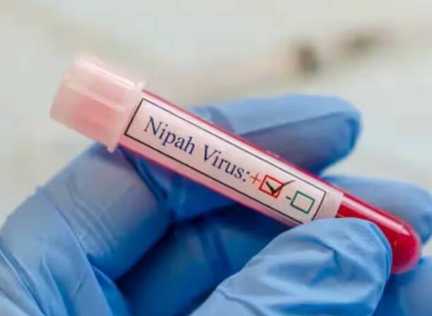 Nipah Virus:  ਨਿਪਾਹ ਵਾਇਰਸ ਬਿਮਾਰੀ ਇੱਕ ਜ਼ੂਨੋਟਿਕ ਬਿਮਾਰੀ ਹੈ ਜੋ ਜਾਨਵਰਾਂ ਤੋਂ ਮਨੁੱਖਾਂ ਵਿੱਚ ਫੈਲਦੀ ਹੈ।