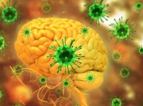 ਨਿਪਾਹ ਵਾਇਰਸ ਦੀ ਲਾਗ ਤੋਂ ਬਾਅਦ ਸਰੀਰ ਵਿੱਚ ਇਸ ਤਰ੍ਹਾਂ ਦੀ ਸਮੱਸਿਆ ਦਿਖਾਈ ਦੇ ਸਕਦੀ ਹੈ। ਉਦਾਹਰਣ ਲਈ, ਦਿਮਾਗ ਵਿੱਚ ਸੋਜ ਅਤੇ ਇਨਸਫੇਲਾਈਟਸ ਵਰਗੀਆਂ ਖਤਰਨਾਕ ਬਿਮਾਰੀਆਂ ਵੀ ਹੋ ਸਕਦੀਆਂ ਹਨ।