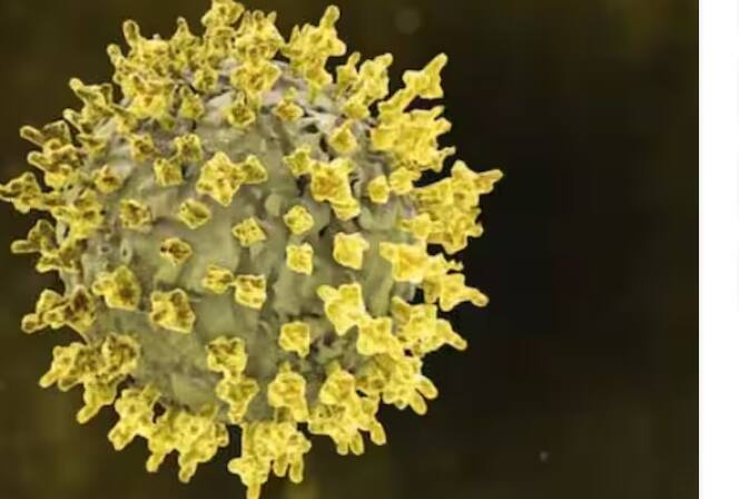 'ਵਰਲਡ ਹੈਲਥ ਆਰਗੇਨਾਈਜ਼ੇਸ਼ਨ' ਦੇ ਮੁਤਾਬਕ ਜੇਕਰ ਅਸੀਂ ਨਿਪਾਹ ਵਾਇਰਸ ਨੂੰ ਖਤਮ ਕਰਨਾ ਚਾਹੁੰਦੇ ਹਾਂ ਜਾਂ ਇਸ ਦੇ ਵਧਦੇ ਮਾਮਲਿਆਂ 'ਤੇ ਕਾਬੂ ਪਾਉਣਾ ਚਾਹੁੰਦੇ ਹਾਂ ਤਾਂ ਇਹੀ ਇੱਕੋ ਇੱਕ ਹੱਲ ਹੈ। ਜੋ ਕਿ ਵੱਧ ਤੋਂ ਵੱਧ ਲੋਕਾਂ ਨੂੰ ਇਸ ਬਾਰੇ ਜਾਗਰੂਕ ਕਰਨਾ ਹੈ।